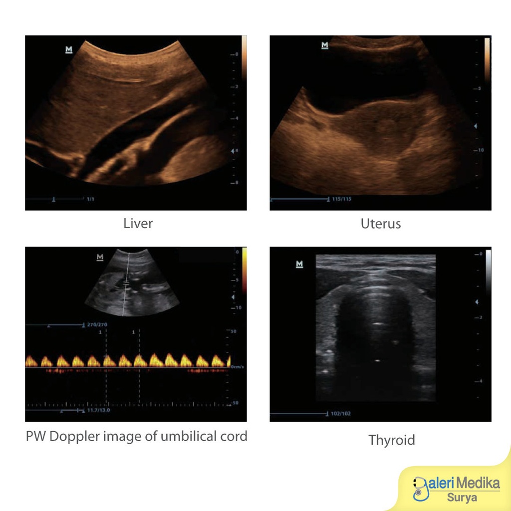 Alat USG 2D Mindray DP-10 Digital Doppler Ultrasound System LED Screen 12.1"